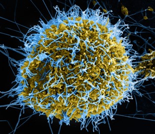 Ataque de vírus do Ebola (azuis) a uma célula de macaco, em imagem dos laboratórios do Instituto Nacional de Alergia e Doenças Infecciosas dos Estados Unidos. NIAID/Flickr